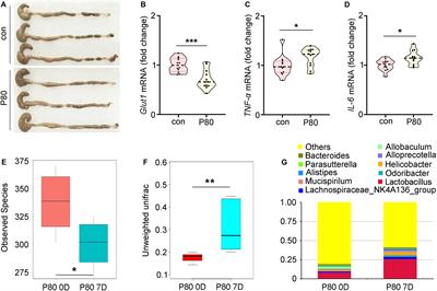 Gut Microbiota Metabolite Fights Against Dietary Polysorbate 80-Aggravated <mark class="highlighted">Radiation Enteritis</mark>